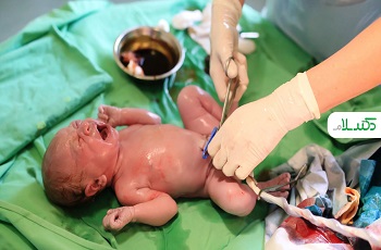 خون بند ناف چیست؟ / چرا ذخیره خون بند ناف نوزاد مهم است؟